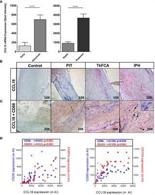 CCL18 aggravates atherosclerosis by inducing CCR6-dependent T-cell influx and polarization